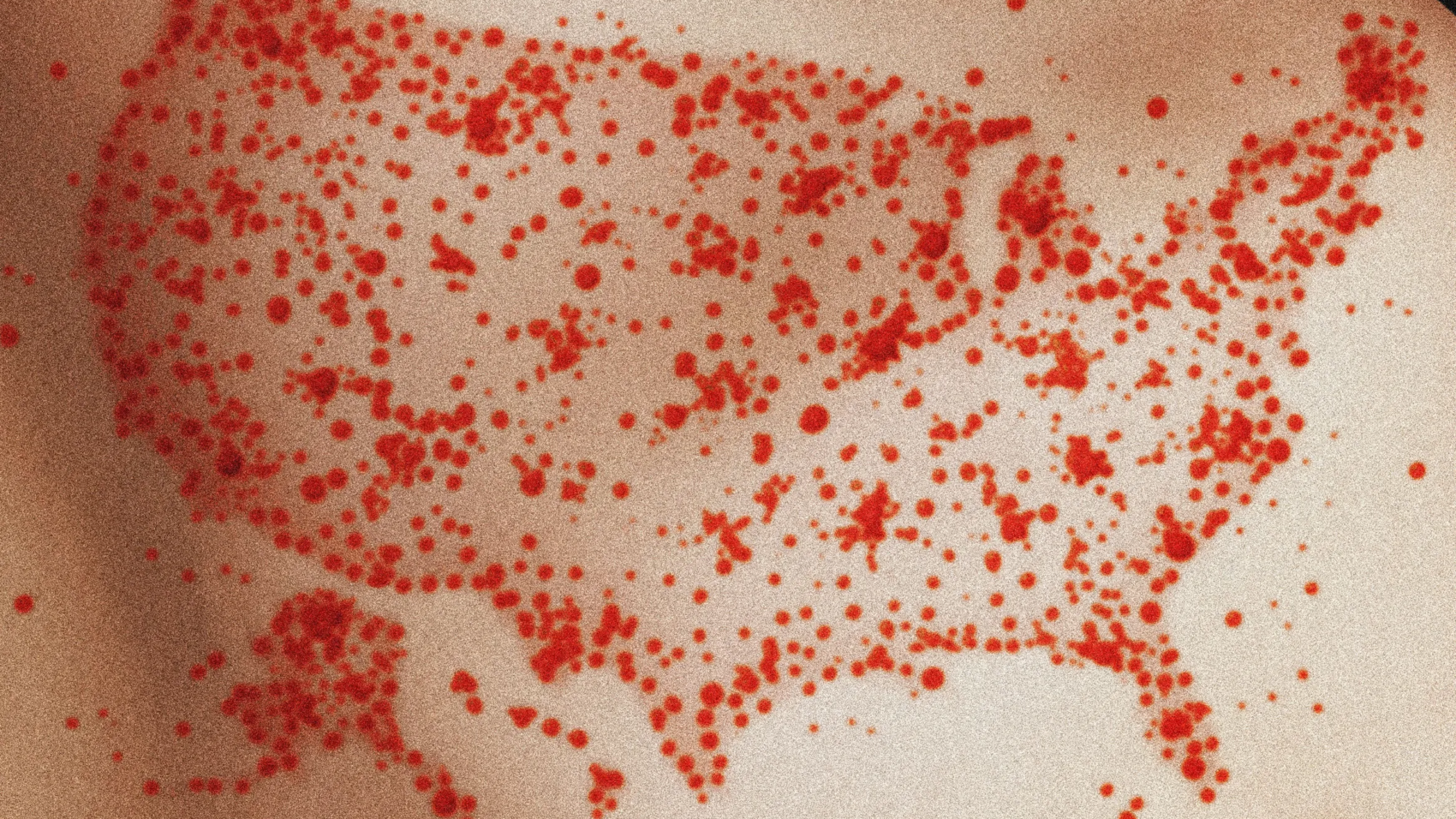 New Study Says Measles Could Become Endemic: 3 Key Takeaways