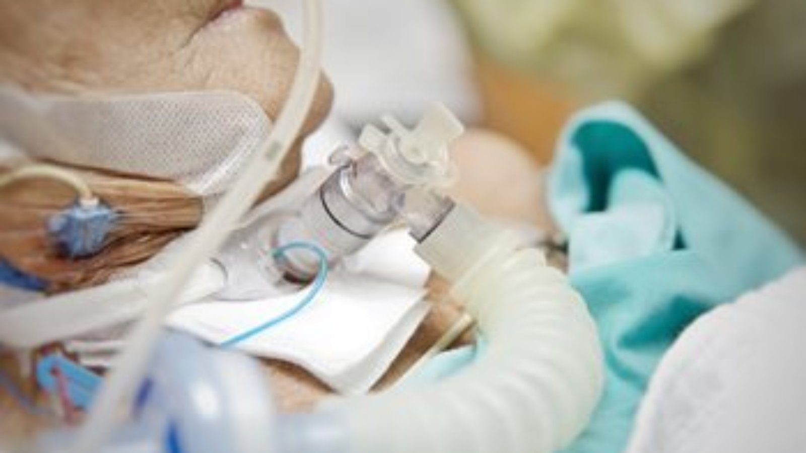 Tracheostomy Tube Care at Home in Islamabad – Trusted Services by Lajpal Care
